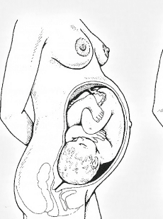 Geburtslage des Kindes, Schädellage, Beckenendlage